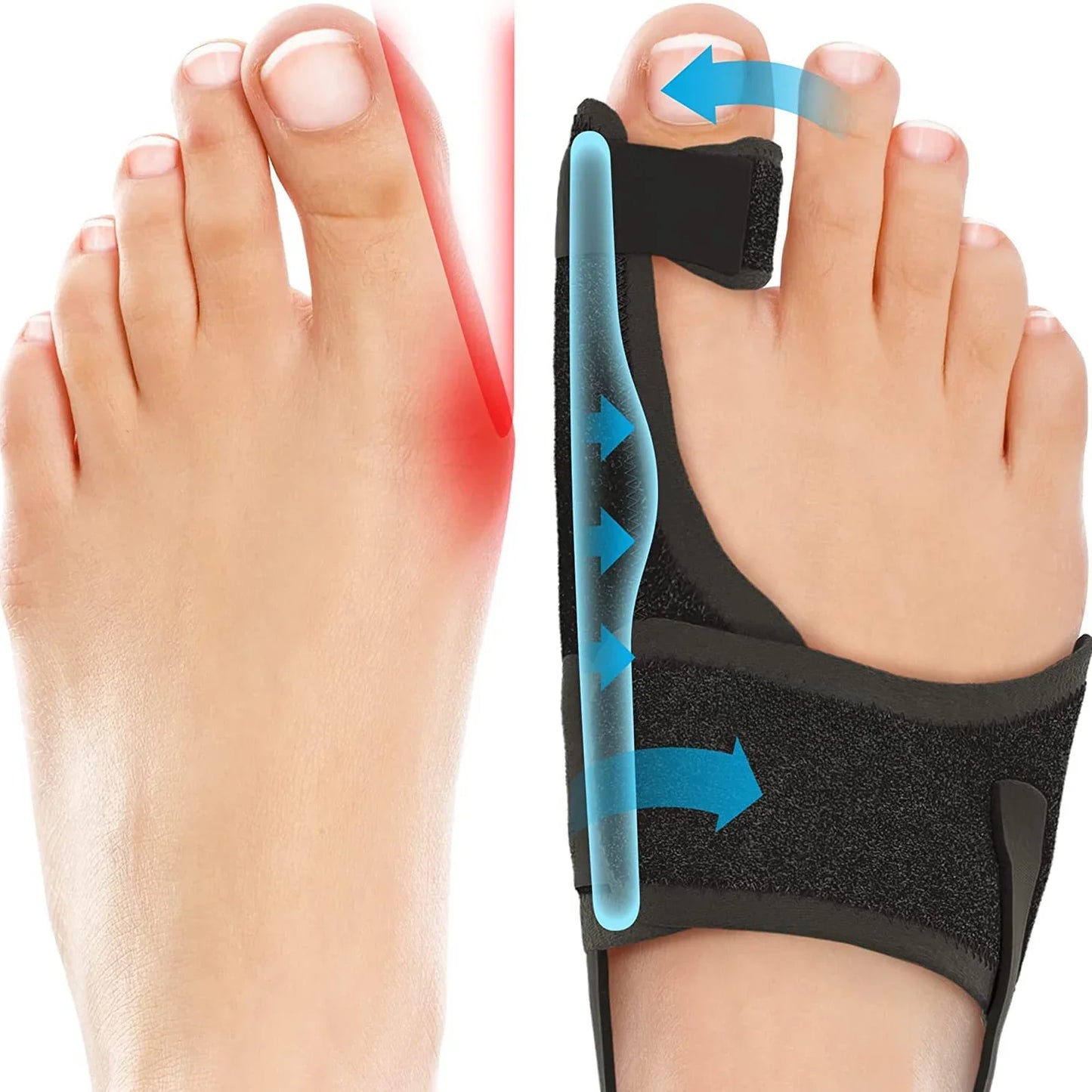 Orthopedic Bunion Splint For Hallux Valgus Pain Relief Foot Support