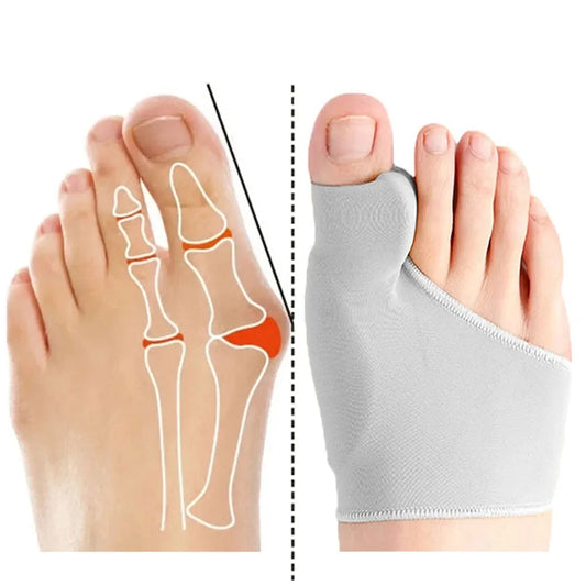 MOOYOU Toe Separator Hallux Valgus Bunion Corrector Orthotics