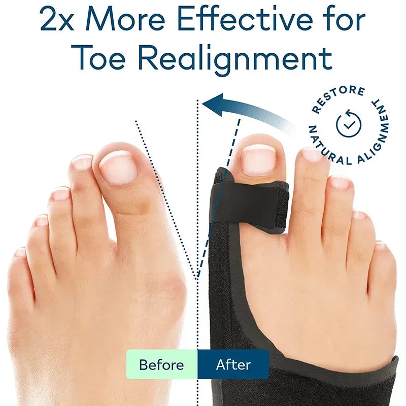 Orthopedic Bunion Splint For Hallux Valgus Pain Relief Foot Support
