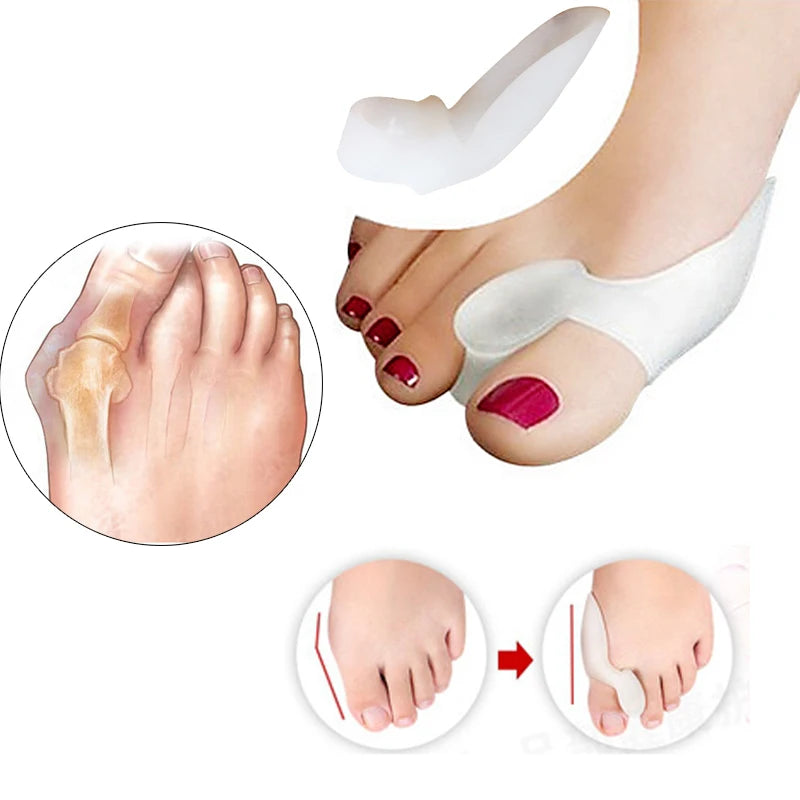 Silicone Toe Separator For Hallux Valgus Correction