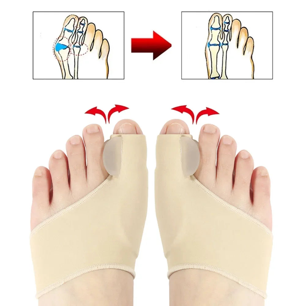 MOOYOU Toe Separator Hallux Valgus Bunion Corrector Orthotics