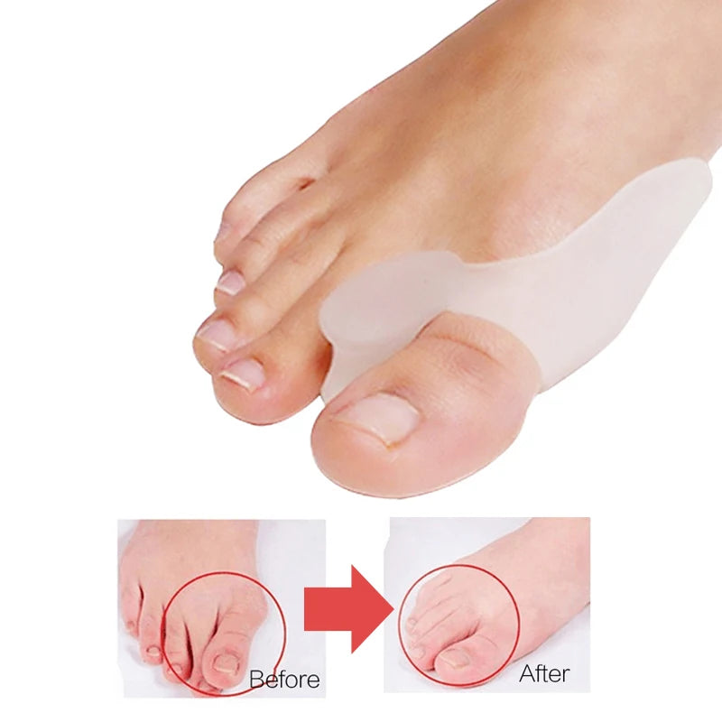 Silicone Toe Separator For Hallux Valgus Correction